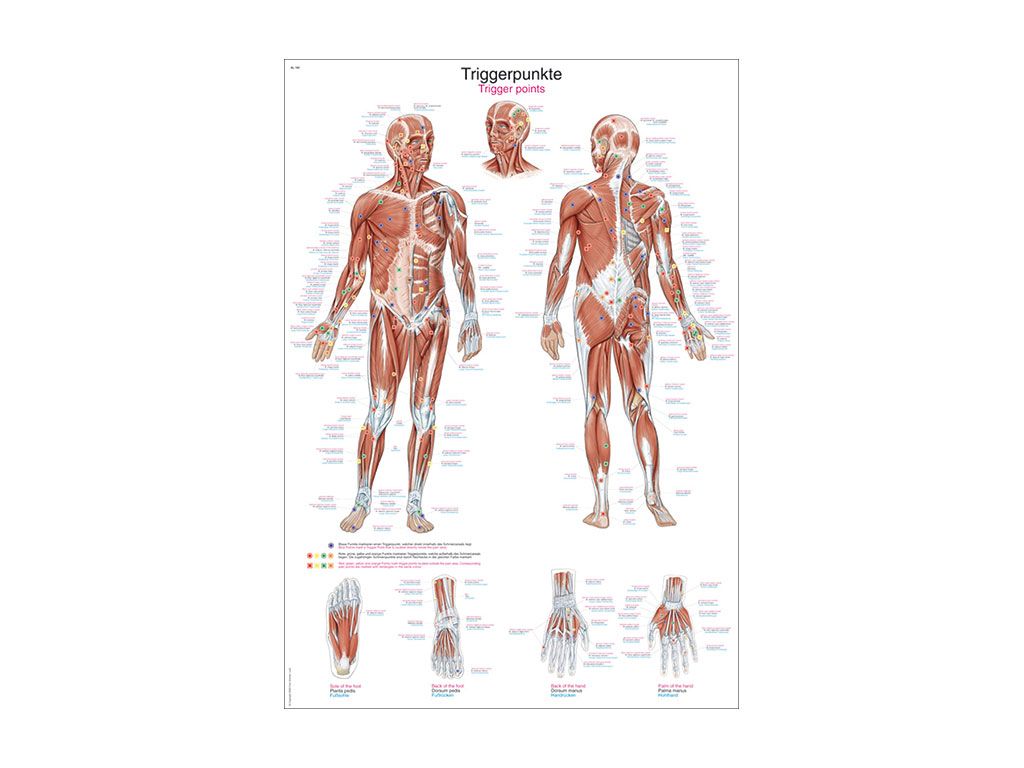 Lehrtafel: Triggerpunkte, 50 X 70 Cm